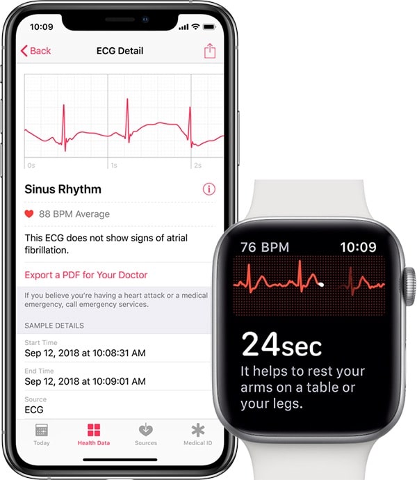 electrocardiogramas apple watch series 4